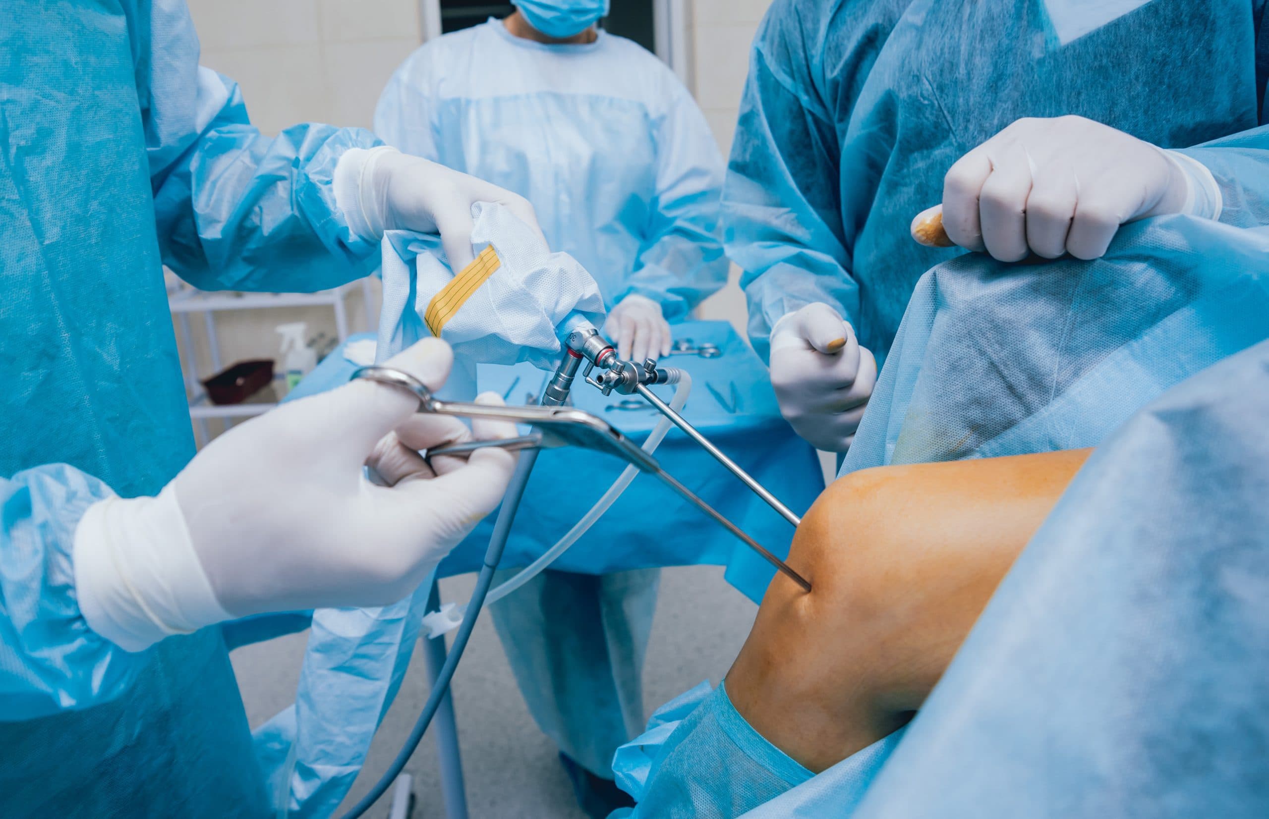 Arthroscopic cartilage surgery in progress