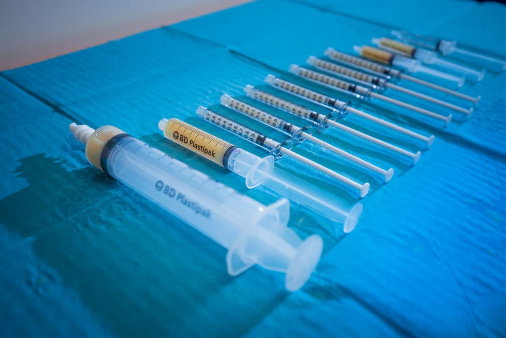 Syringes arranged on sterile blue drape